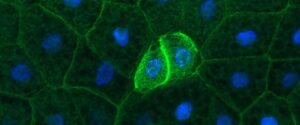 Green and blue dyes illuminate fat cells in a fruit fly
